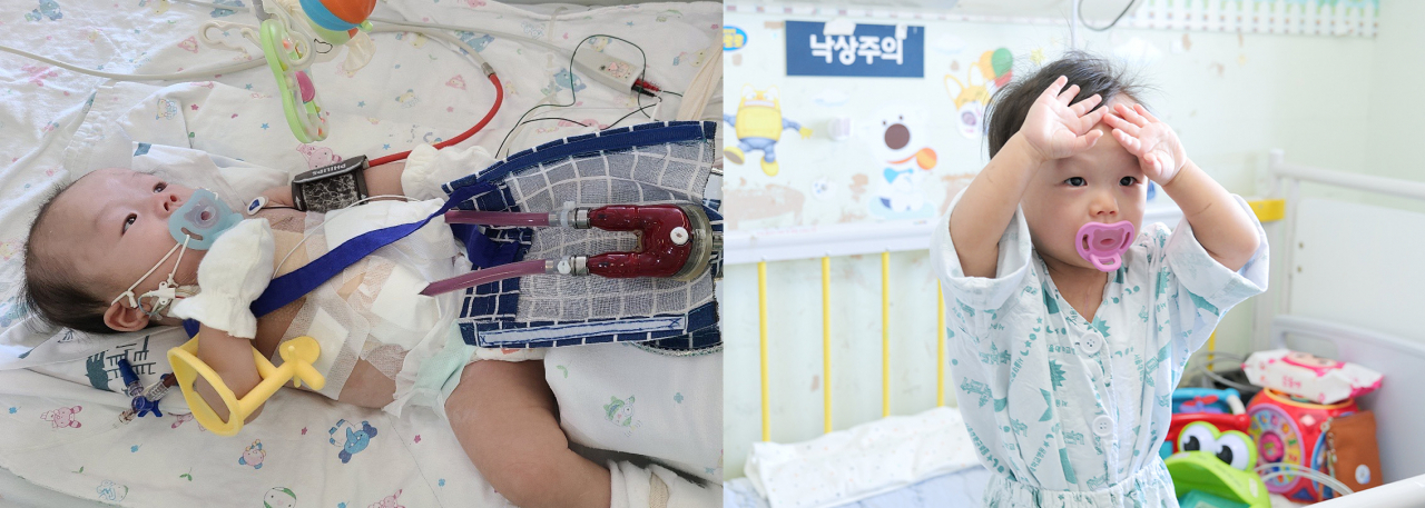 [사진 왼쪽부터] 체외형 심실보조장치를 삽입한 권순후 환아, 퇴원을 앞둔 권순후 환아