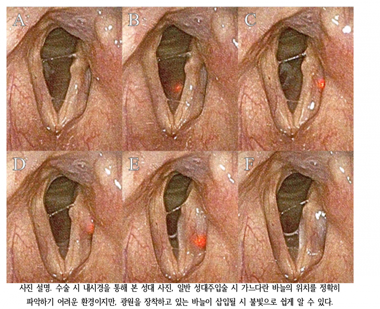 [분당서울대병원 제공]