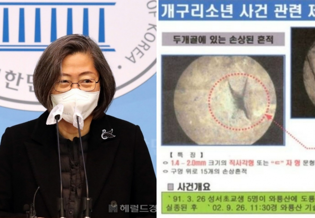 이수정 교수(좌), 개구리소년 사건 피해 어린이 두개골 사진 [이상섭 기자, 대구 달서경찰서]