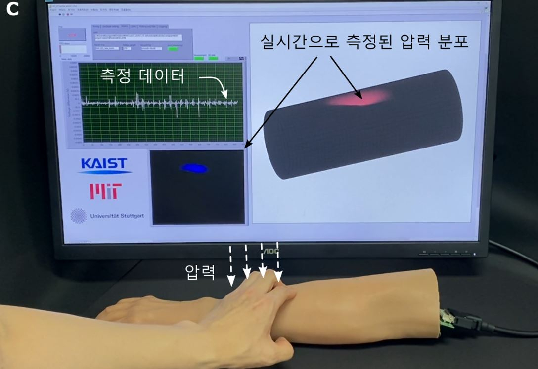 생체모사 로봇피부의 구조를 미용 의수에 적용한 모습.[KAIST 제공]