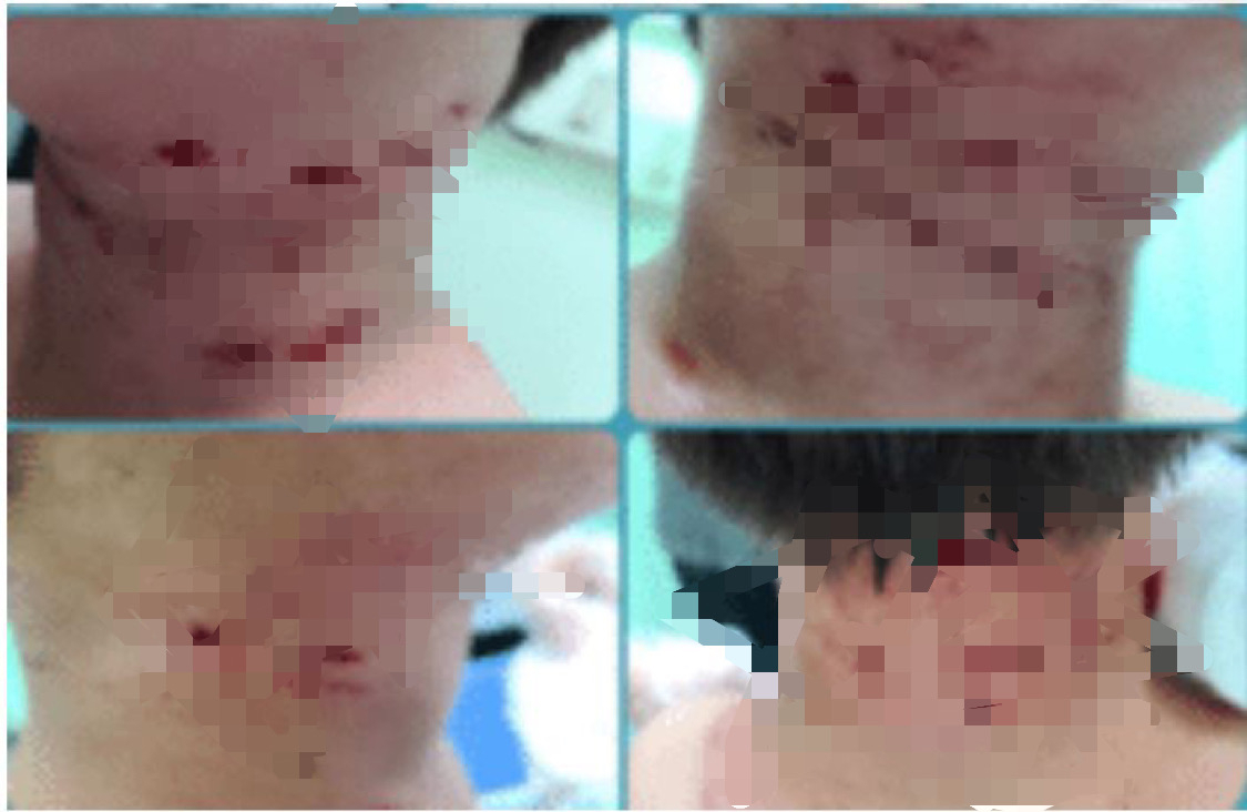 울산의 한 아파트 단지에서 개물림 사고를 당한 초등학생. [온라인커뮤니티]
