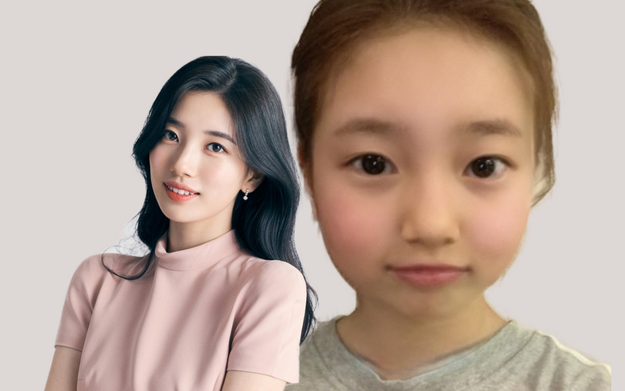 수지→아기 얼굴” 귀엽다 난리더니, 순식간에 망가진 이곳 - 헤럴드경제