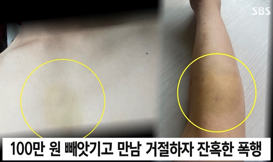 [SBS]