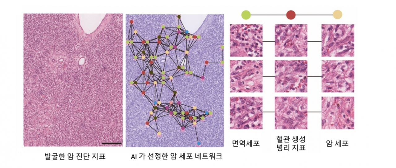 서울대 공동연구팀이 밝혀낸 혈관 형성과 관련된 암 진단 지표 [서울대 제공]