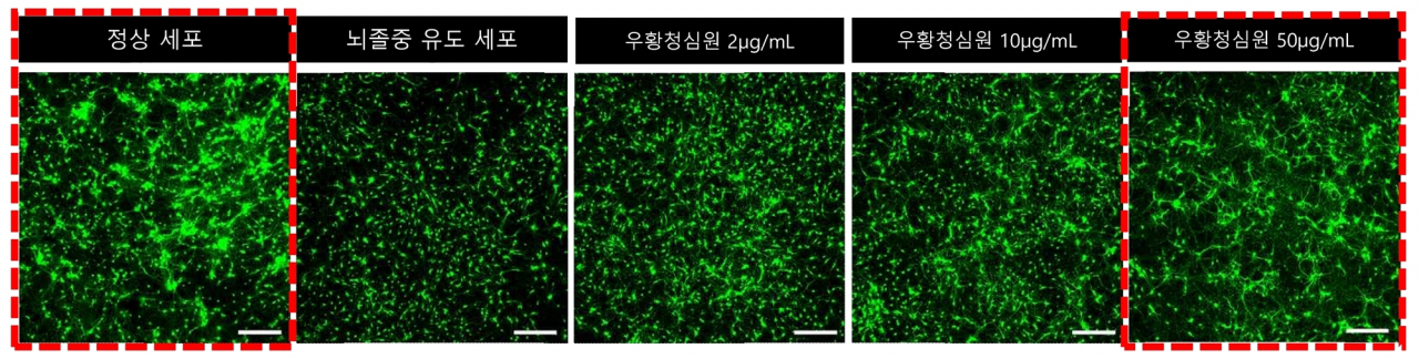 [사진설명] 우황청심원은 농도에 비례해 뇌졸중 상태를 유도한 대뇌피질 신경세포 사멸을 억제했다