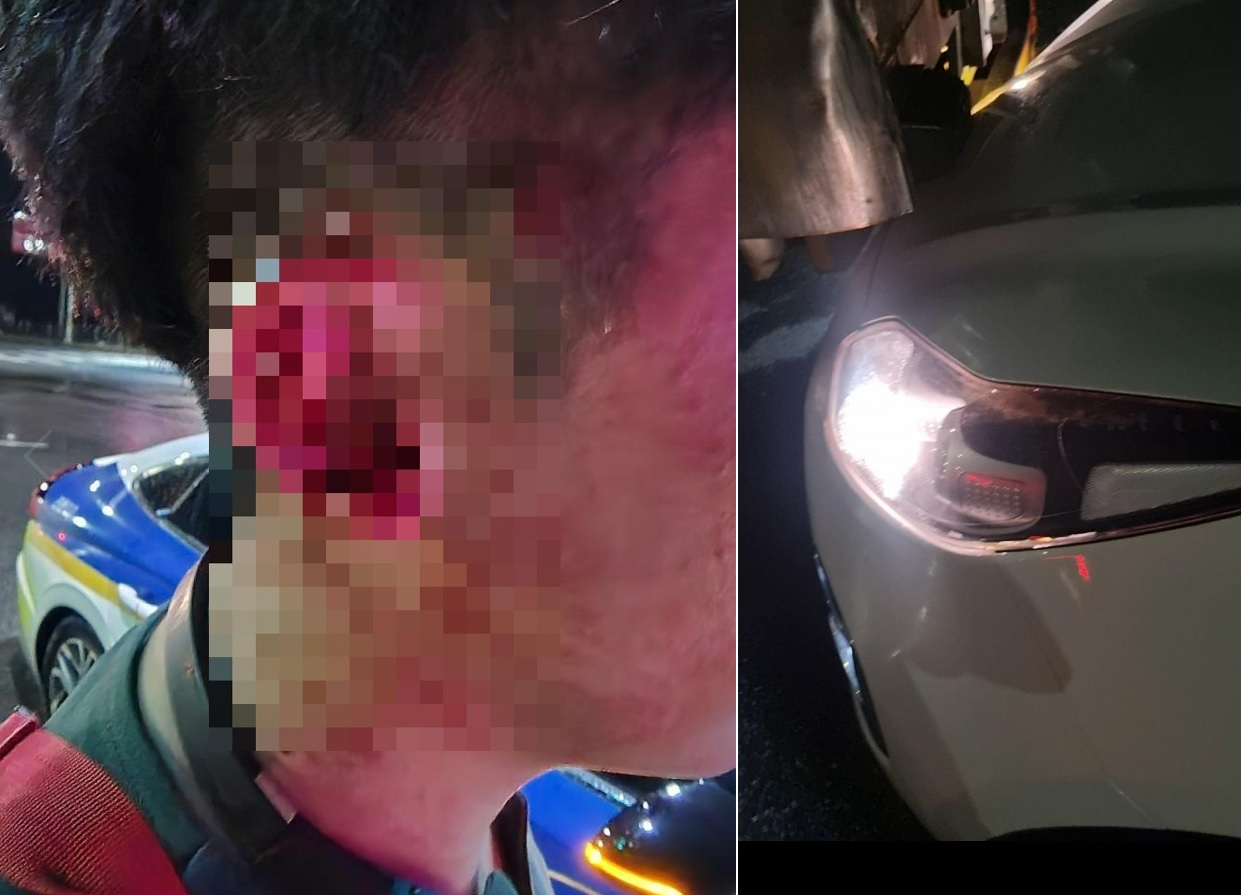 폭행 당한 대리기사가 피해를 호소하며 직접 공개한 사진 [온라인 커뮤니티]