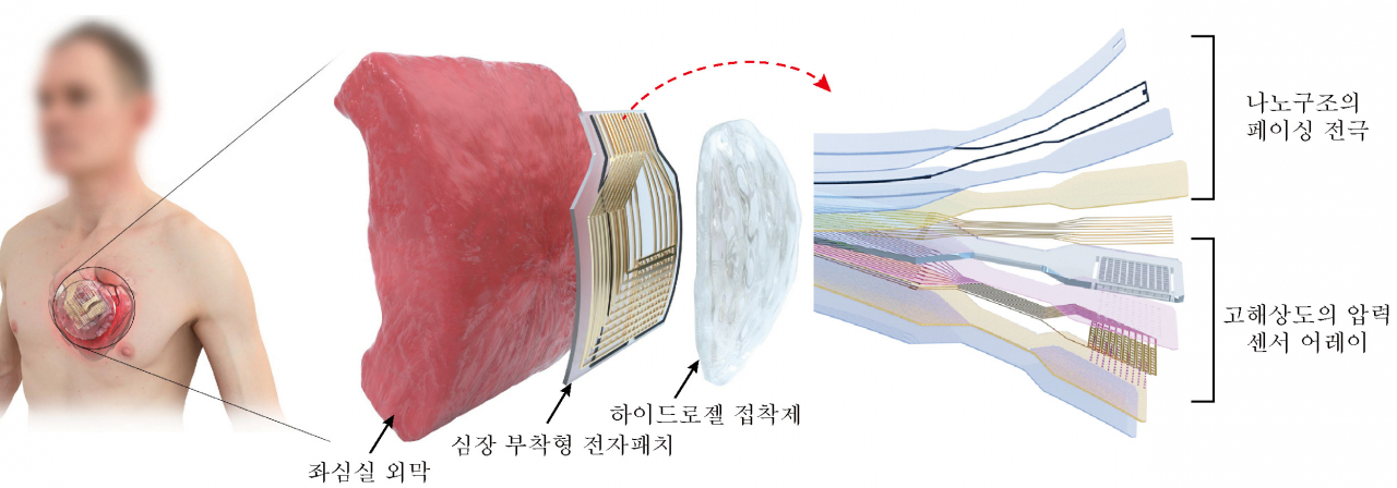 심장 부착 패치형 디바이스 플랫폼 설계.[IBS 제공]