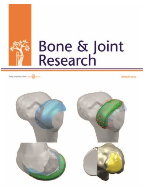 연세사랑병원은 최근 발표한 논문이 ‘Bone & Joint Research’의 표지를 장식했다고 밝혔다. 이로써 연세사랑병원은 7년 만에 인공관절 논문 100편을 달성하게 됐다. 관절 단일병원으로는 최대 건수다.