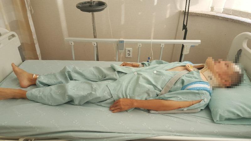 전동킥보드와 충돌 후 목뼈와 두개골에 금이 간 피해자가 병원에서 치료를 받고 있다.[보배드림]