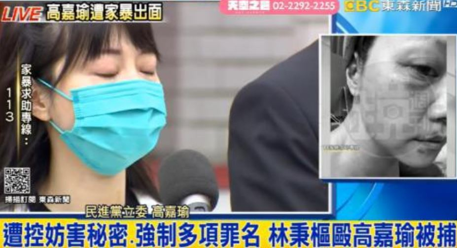 기자회견하는 가오자위 입법위원(왼쪽). 구타당한 사진[인터넷 커뮤니티 캡처]
