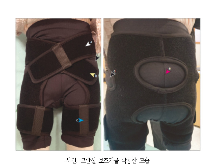 [분당서울대병원 제공]