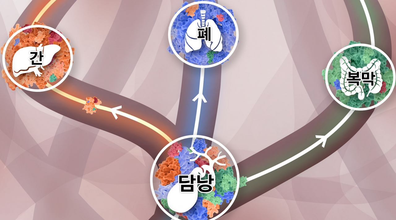 담낭에 다양한 클론들이 섞여 있다가, 주황색 클론이 이긴 암세포는 간으로, 파란색 클론이 이긴 암세포는 폐로, 초록색 클론이 이긴 암세포는 복막으로 간다.분당서울대병원 제공]