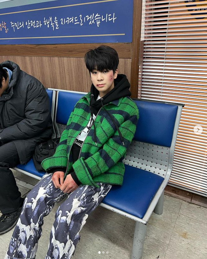 가수 정동원. 사진은 기사 속 사건과 무관함. [정동원 인스타그램]