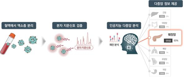 “피 10방울만 뽑으면 돼” 암 찾아내는 무서운 신기술 나왔다