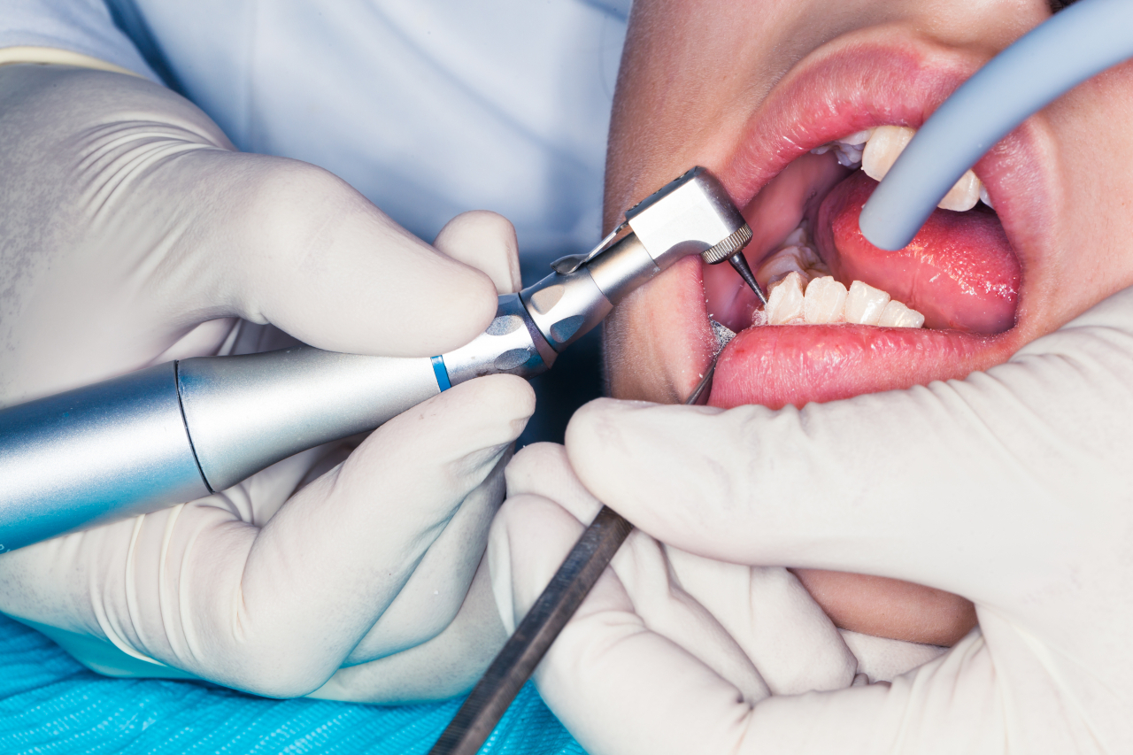 충치치료에만 수십만원, 치과는 건보 사각지대[김용훈의 먹고사니즘] - 헤럴드경제