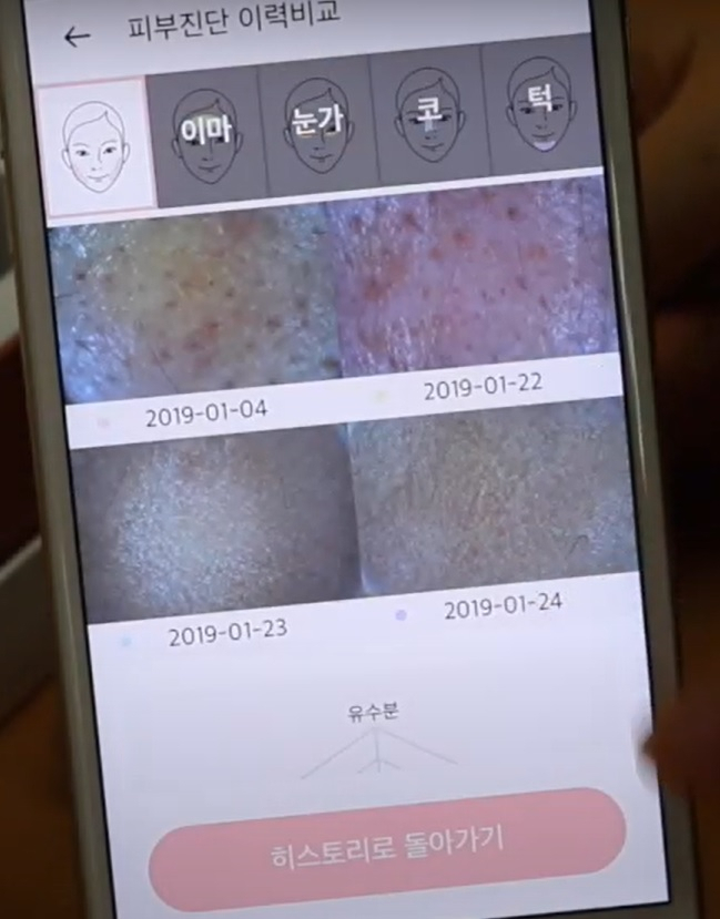 피부 진단 사진을 앱을 통해 확인할 수 있다[릴리커버 홍보 영상 갈무리]