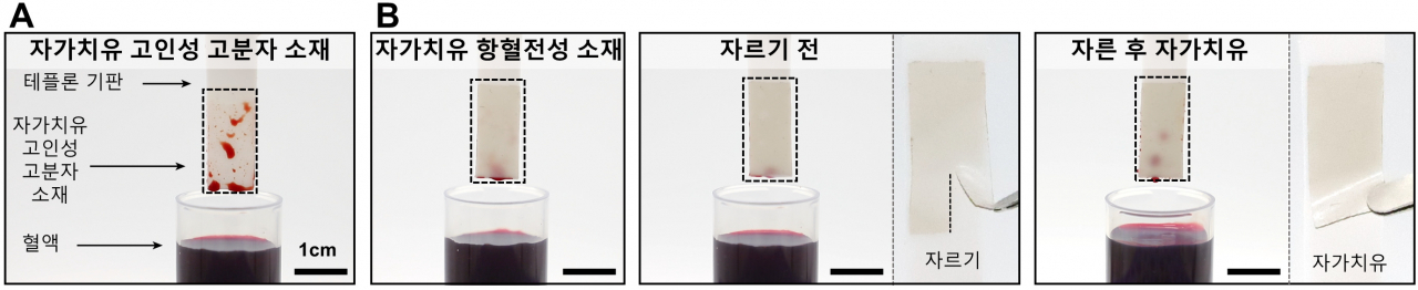 기존 인공혈관 소재와 자가치유 항혈전성 인공혈관 소재 표면에서의 혈액 부착 양상 비교.[연세대학교 제공]