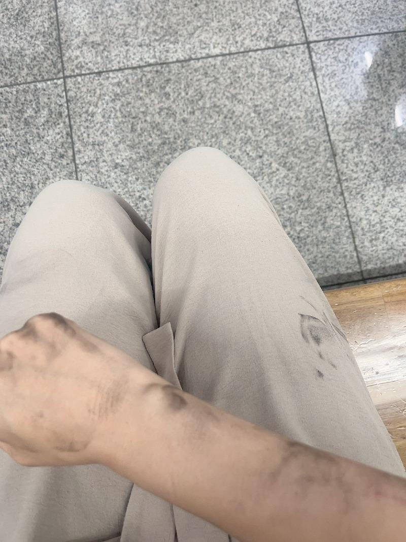 A씨가 지하철 9호선 전동차 안에서 쓰러진 뒤 병원에서 의식을 차린 뒤 찍은 자신의 팔뚝 사진. [보배드림 갈무리]