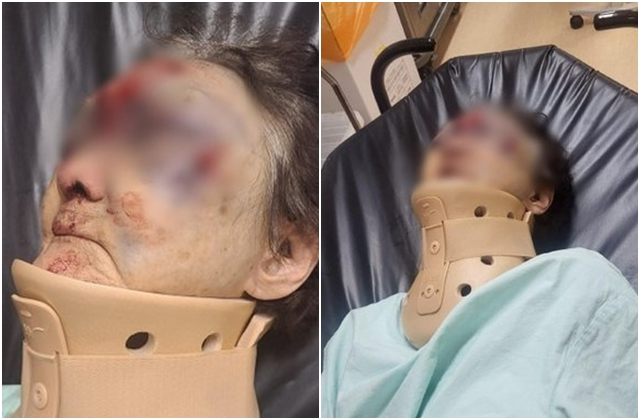 실종 6시간 만에 전신에 부상을 입은 채 발견된 80대 치매 할머니. [보배드림 캡처]