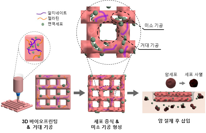 3D 바이오프린팅 NK세포 면역 치료과정 모식도.[한국기계연구원 제공]