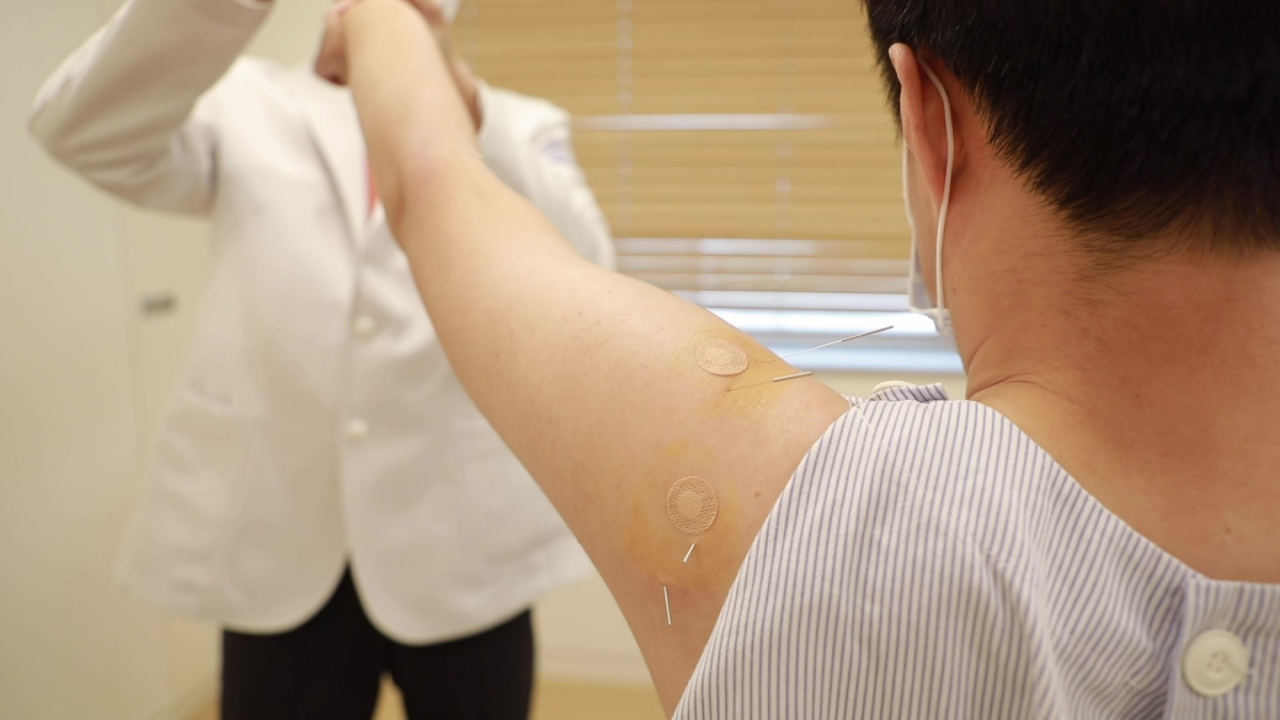 자생한방병원 의료진이 견관절 장애 환자에게 동작침법을 시행하고 있다