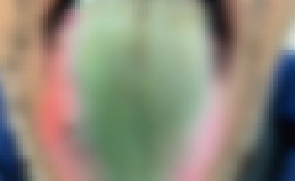 [뉴잉글랜드 저널 오브 메디슨]