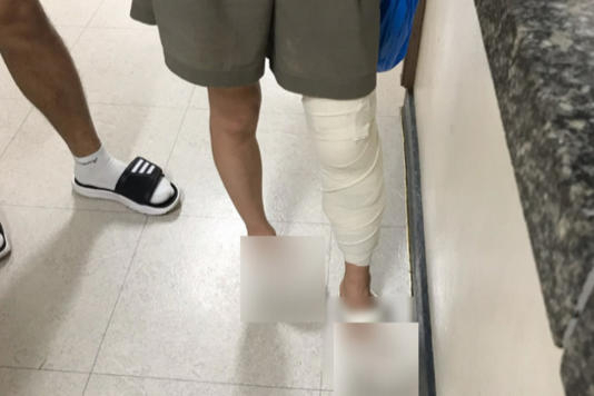 싸이 흠뻑쇼 여수 공연 직후 다리에 부상을 입어 봉합 후 붕대를 감은 모습[노컷뉴스]