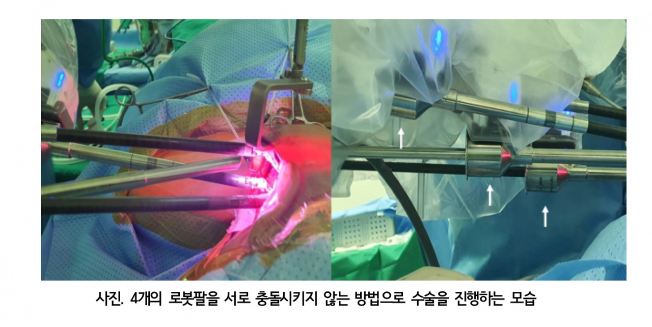 [분당서울대병원 제공]