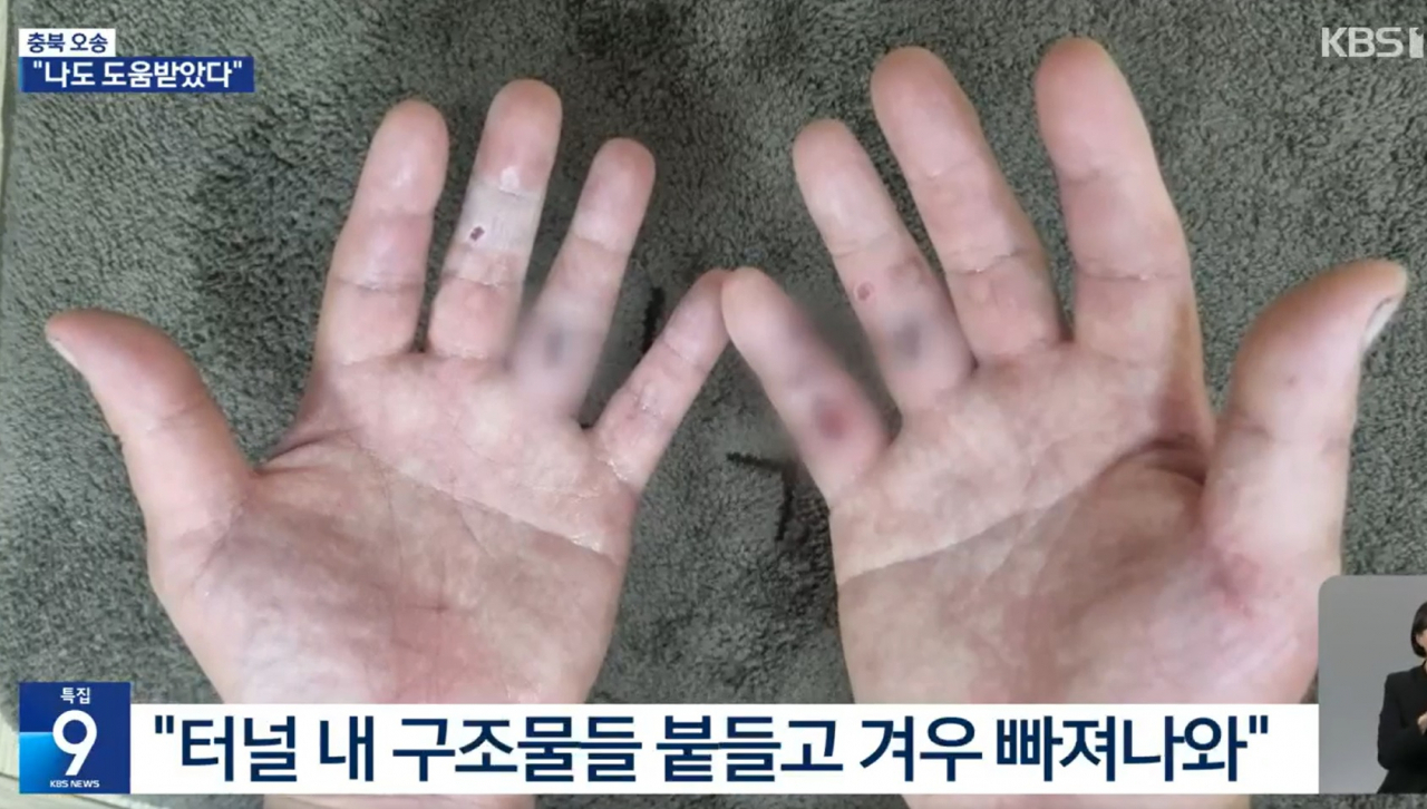 구조자 정영석씨 손. [KBS뉴스 영상 갈무리]