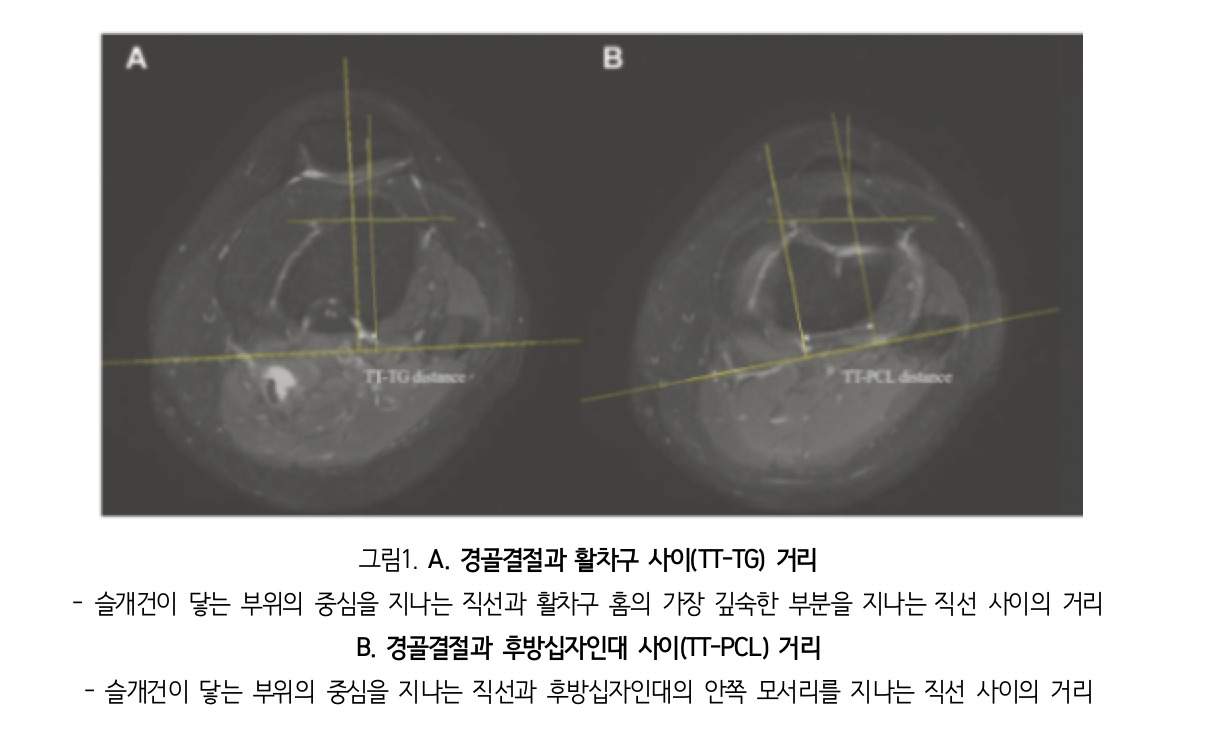 [분당서울대병원 제공]