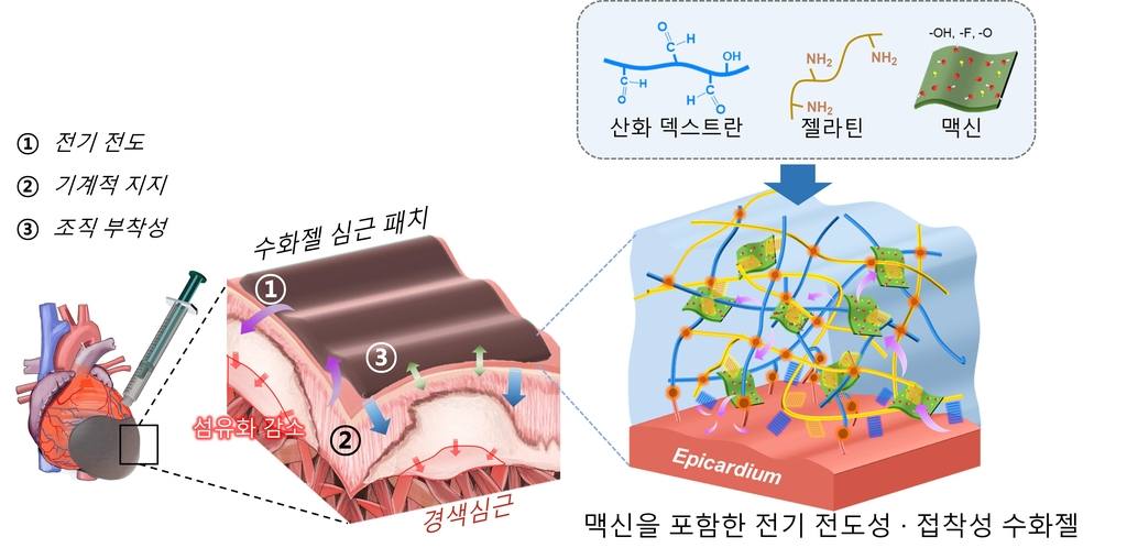 전도성 수화젤 심근패치[지스트 제공.재판매]
