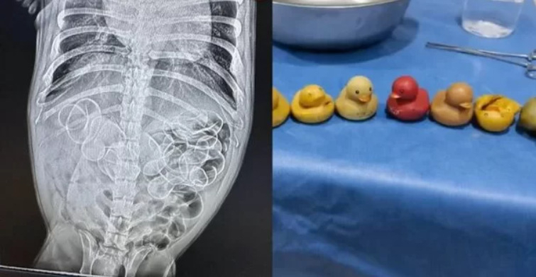 반려견의 배를 엑스레이로 찍은 사진(왼쪽)과 수술을 통해 뱃속에서 꺼낸 고무 오리 인형들. [뉴욕포스트 갈무리]
