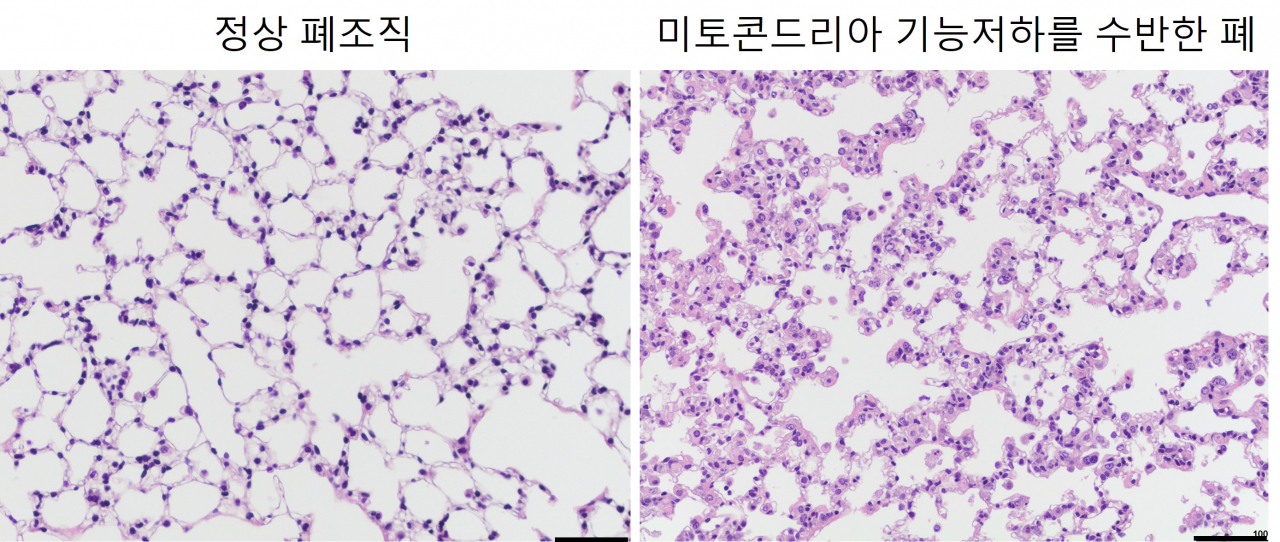 미토콘드리아 기능저하를 가진 쥐의 폐조직은 비정상적인 상태의 폐포조직을 형성하고 있는 것을 확인했다.[노스웨스턴대 제공]