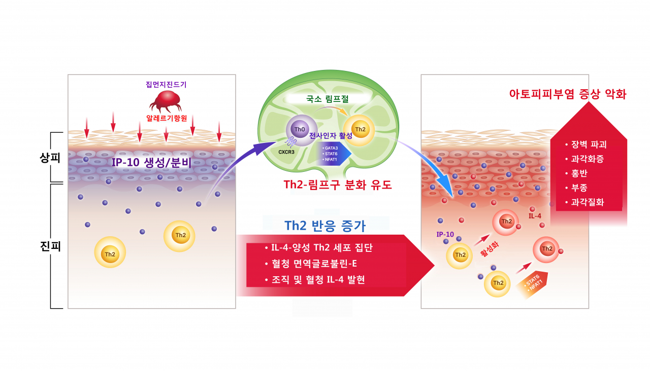 집먼지진드기 민감성 아토피피부염에서 IP-10의 생산과 그 작용 기전.[경북대학교 의과대학 제공]