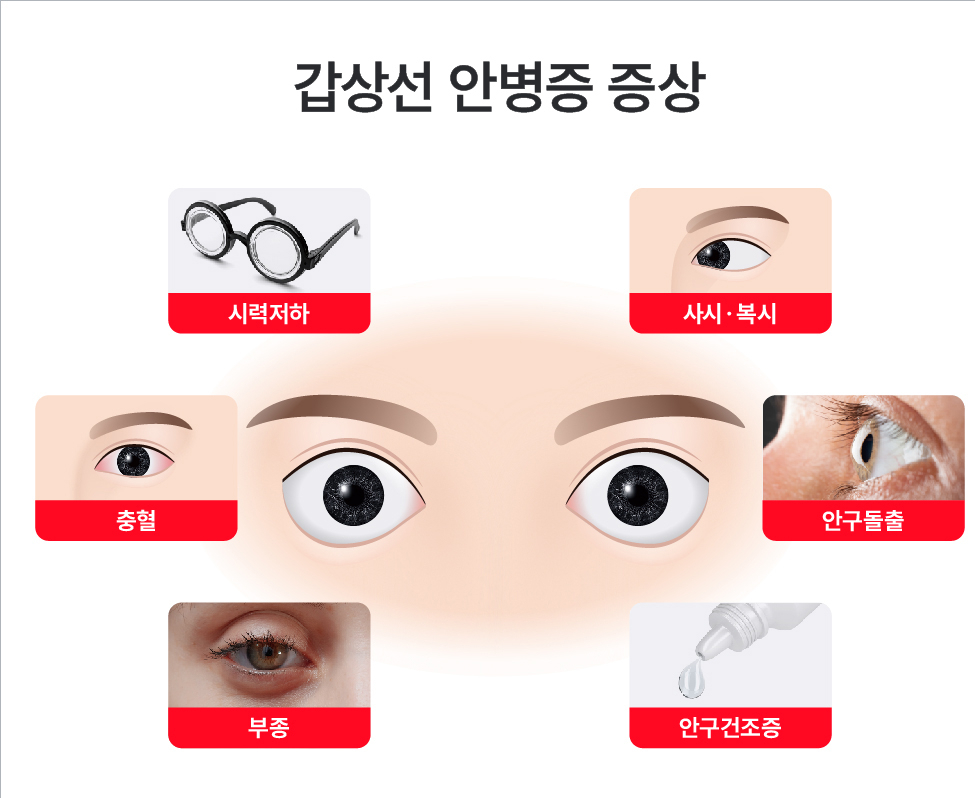 사진=누네안과병원 제공