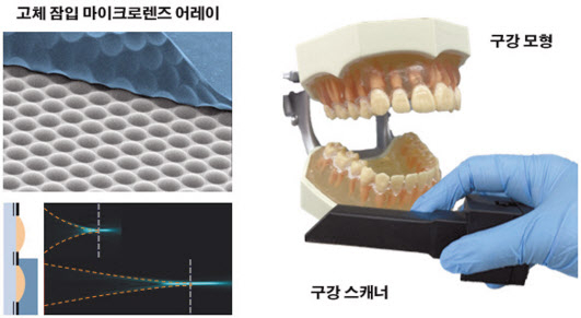 최종 패키징된 라이트필드 카메라 기반 구강 스캐너 및 구강 모형 [KAIST 제공]