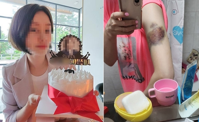 피해자의 살아생전 모습(왼쪽)과 폭행 피해로 멍이 든 모습. [연합]