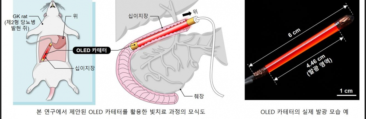 OLED 카테터를 활용한 빛 치료 과정 모식도와 디바이스.[KAIST 제공]