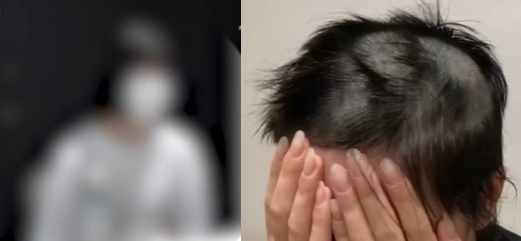 남자친구에게 바리캉으로 머리를 밀리고 폭행과 성폭행을 당한 피해자의 모습. [유튜브 채널 ‘카라큘라 탐정사무소’· MBC ‘실화탐사대’ 캡처]