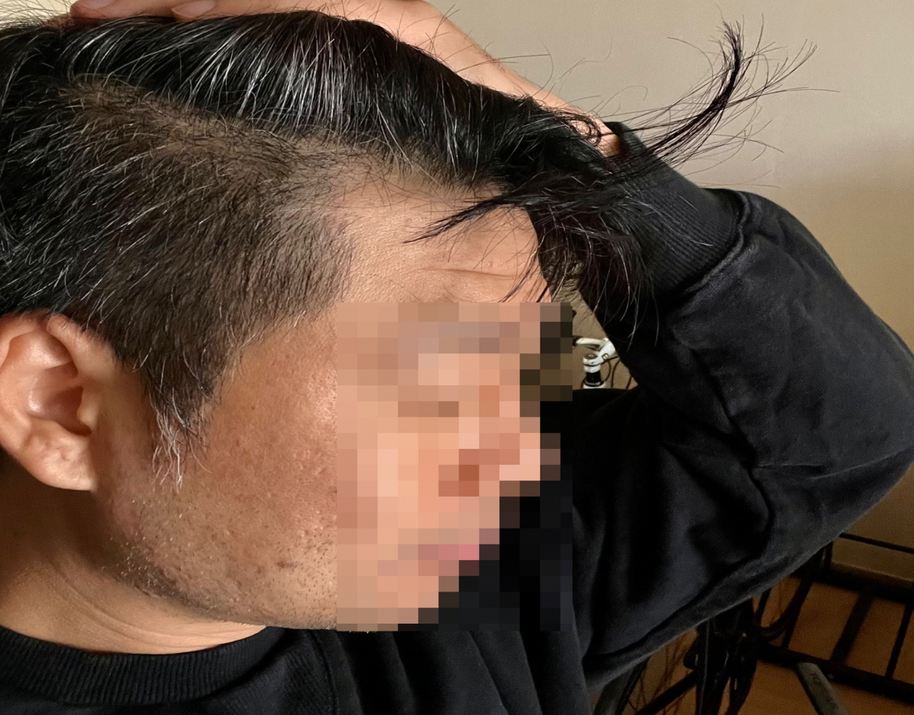 흰머리로 고민 중인 30대 직장인 A씨. [A씨 제공]