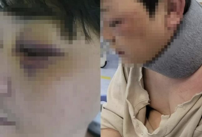 “니네 아빠 X발렸어” 아이 아빠 구타한 김포 40대男, 신상 털렸다