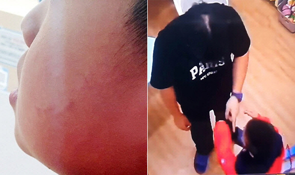 붉어진 B군의 뺨(좌), CCTV에 찍힌 A씨가 B군을 몰아세우는 장면. [연합]