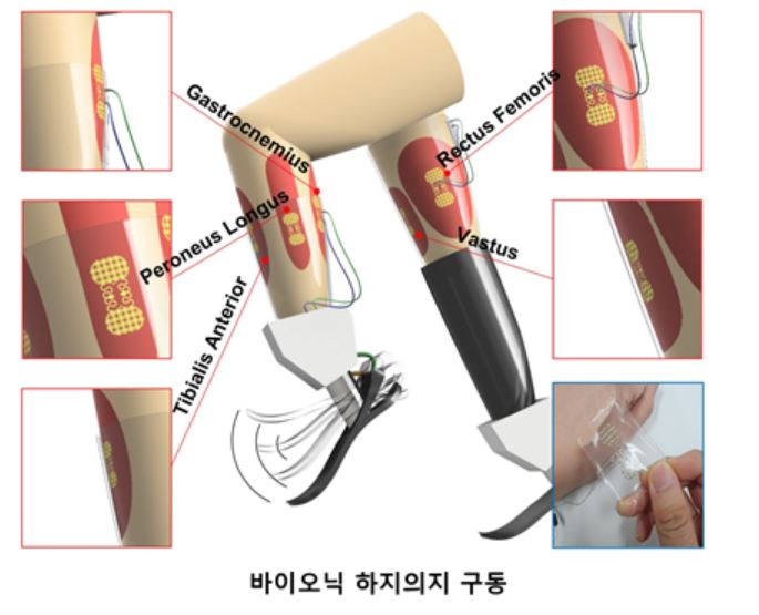 보행을 관장하는 다양한 근육 부위에 부착된 무감각성 표면근전도센서의 이미지.[DGIST 제공]
