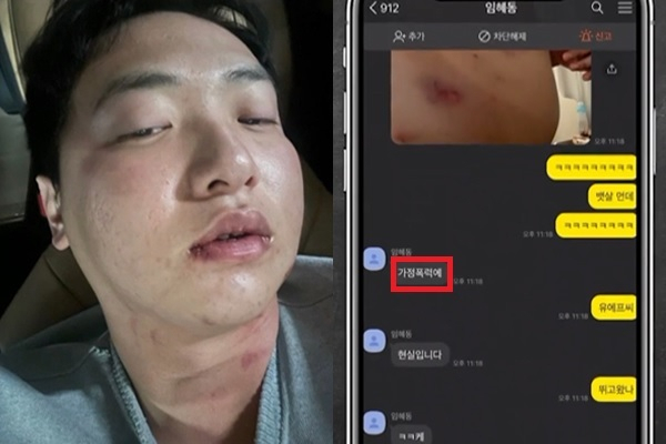 전 야구 선수 임혜동씨가 김하성 선수에게 폭행당했다며 공개한 사진(왼쪽)과 김 선수가 이에 반박하며 증거로 내세운 카카오톡 메시지 내용. [SBS 보도화면]