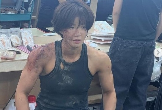 이시영