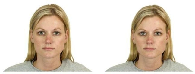 자연스러운 얼굴(왼쪽)과 비대칭으로 조작된 얼굴. [Journal of Psychopharmacology/Alistair J Harvey et al.]