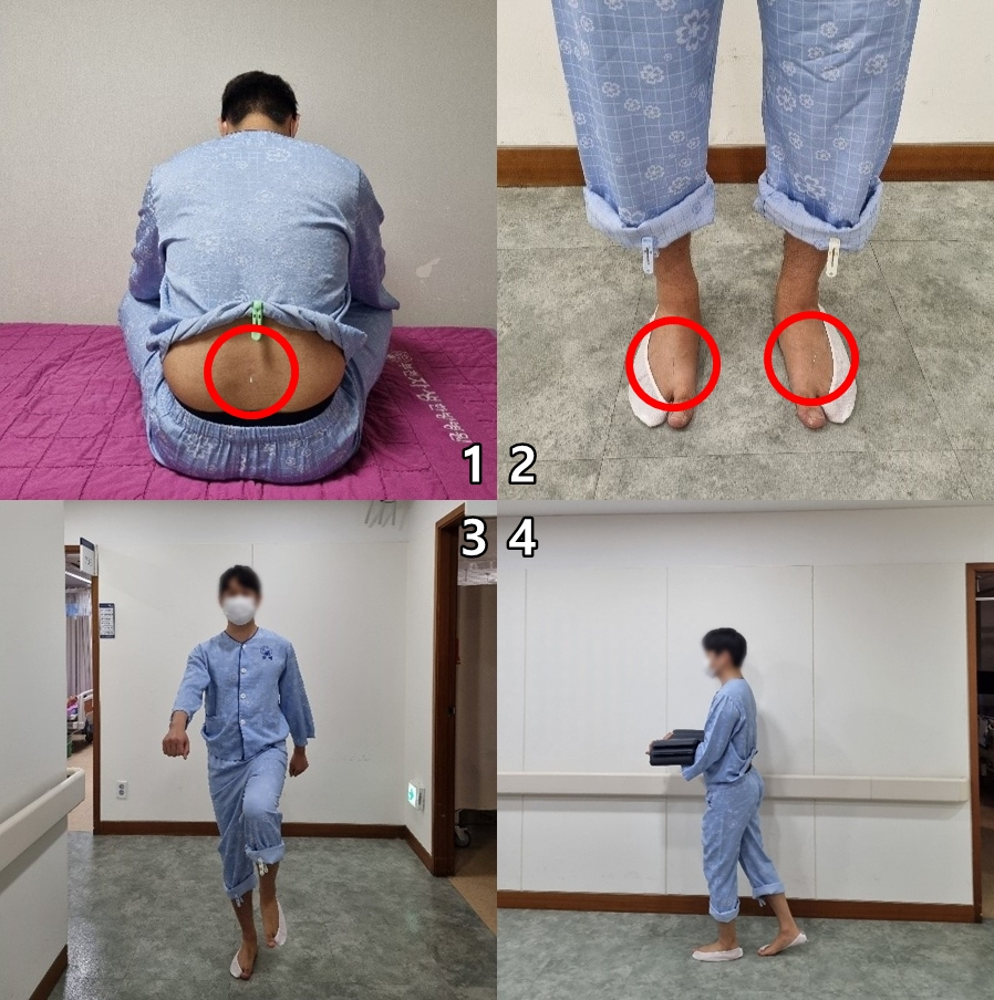 [사진설명] 점진적 부하 동작침법(PL-MSAT)의 과정