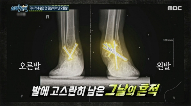 MBC '실화탐사대' 캡처