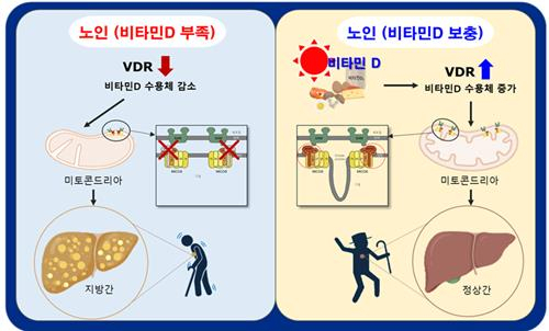 술도 안 마시는데 나이 드니 ‘지방간’ 생겨…‘이것’ 섭취하면 억제!