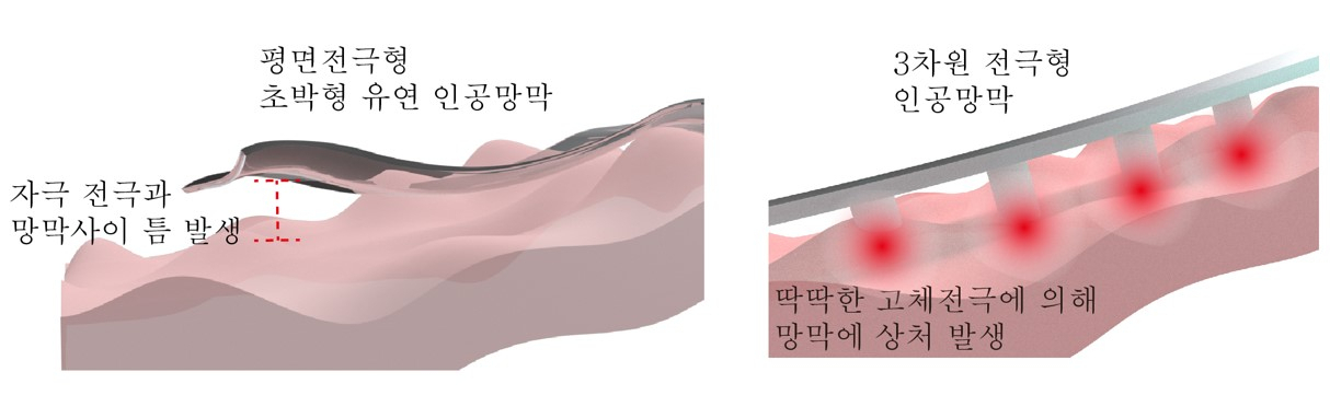 기존 고체 금속 기반의 평면 전극형/3차원 전극형 인공망막의 한계 [세브란스병원 제공]